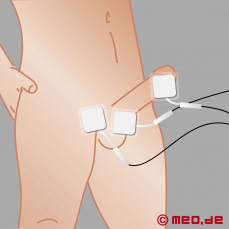 Självhäftande elektroder för stimuleringsström - TENS-elektroder