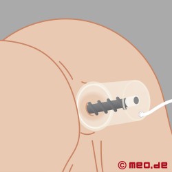 Analpumpe med dildo - Vakuumsylinder for anal dilatasjon - Analpumpe med Dildo Rosebud Driller