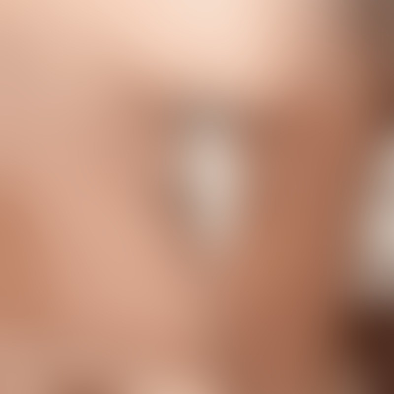 KAWUMM™ von MEO® – Nippelklemme mit frei beweglichem Gewicht - 1