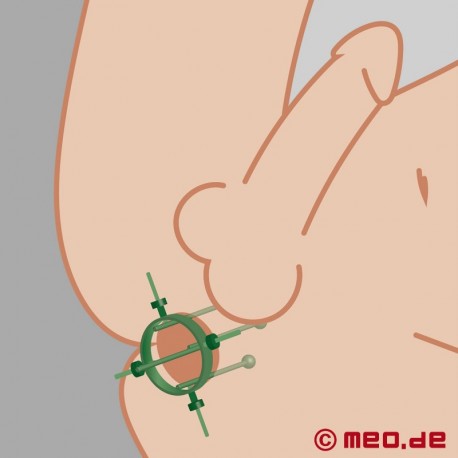 Ring Speculum for Anal Dilation - THE HOLE 2.0