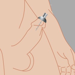 Capuchon pour contrôler le sperme 8 mm
