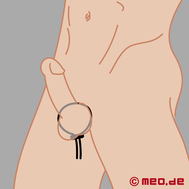 Stud Ring - penisløyfe for elektrostimulering