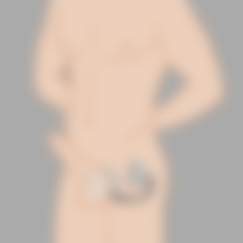 MEO'dan Çift Ass Lock - 2