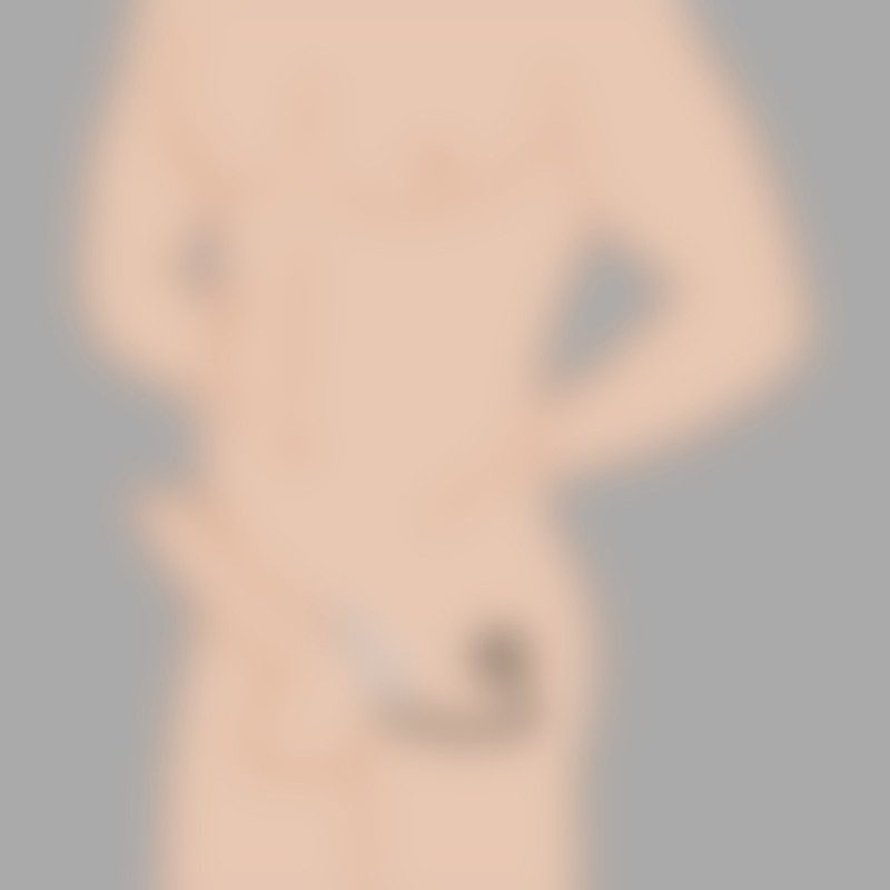 AssLock™ Cockring – L'originale di MEO® Germania - 1