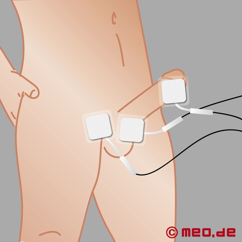 Electrodes autocollantes