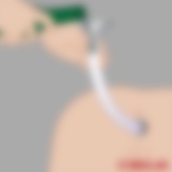 ASS BLASTER 2.0 - Åpen buttplug med tube og trakt - Thumbnail