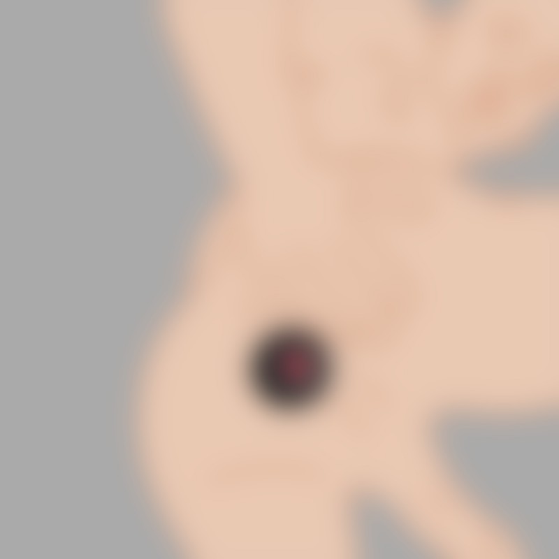 Dilatation anale Ass Grommet - 24/7 Anal Stretching - 2