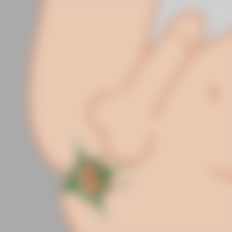 Spekulum för anal stretching "The Hole" - analspreader för extrem spridning och anal stretching - 2