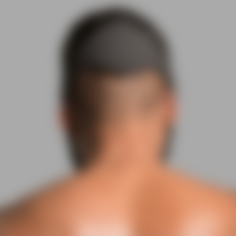 Arany zuhany szorítószáj - 5