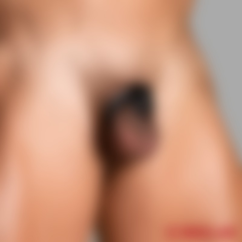 Kyskhetsbelte NoPacha ® Mancage - 1