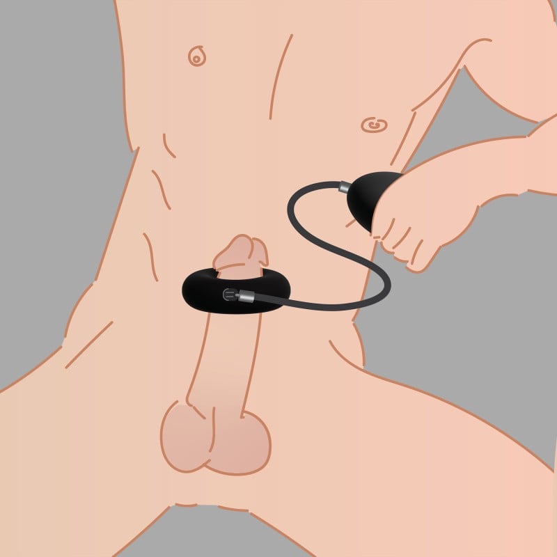 ALLROUNDER - Inflatable cock ring, testicle ring and glans ring