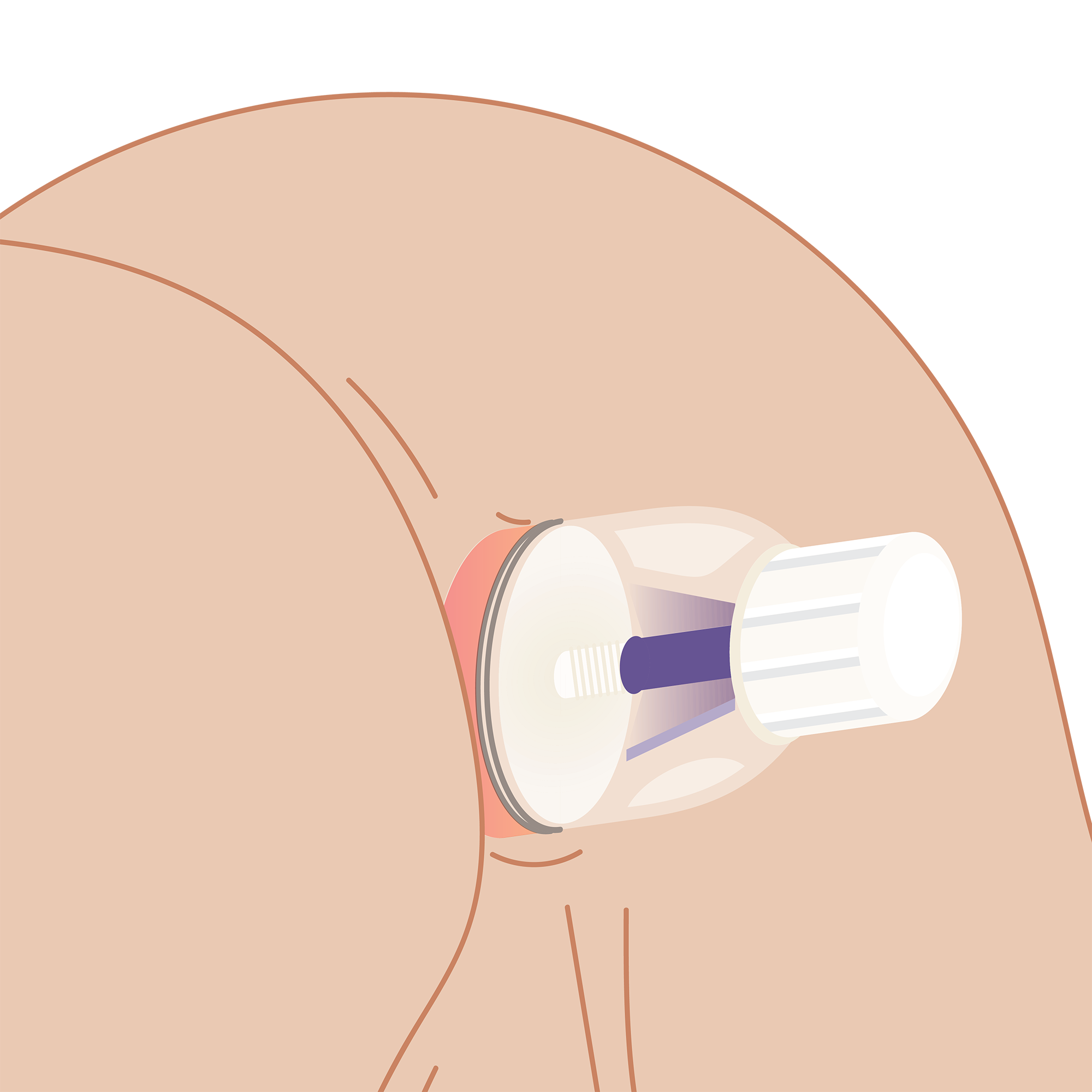 アナルローズバッド 