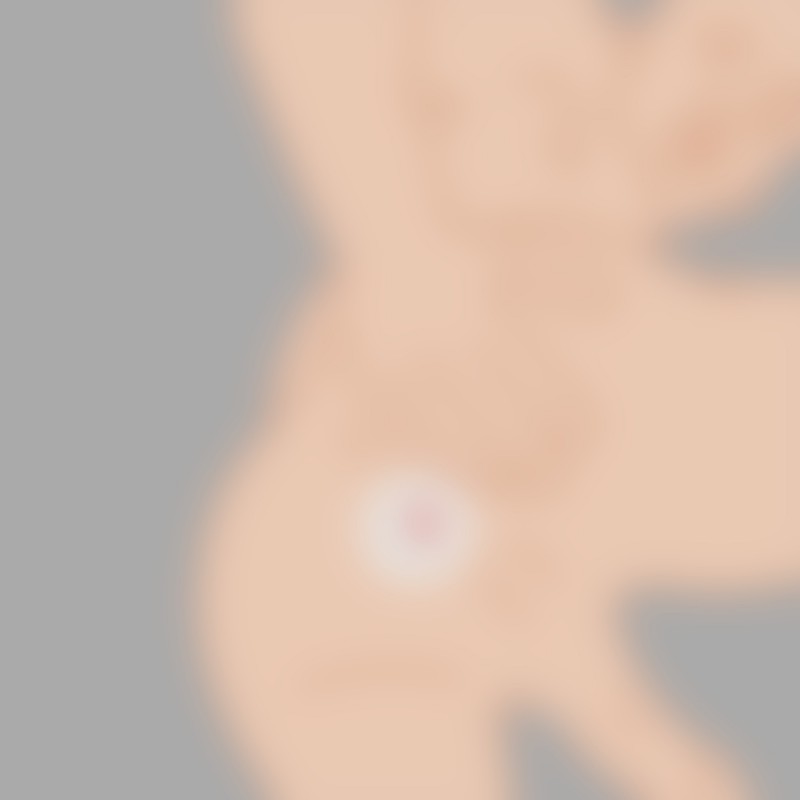 Ass Grommet 2.0 sızdırmazlık tapalı - şeffaf - 1