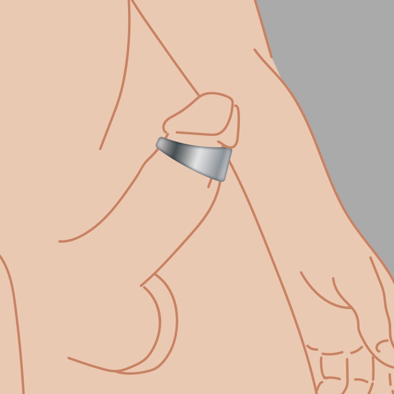 Anello per il glande in acciaio inossidabile particolarmente confortevole - 1