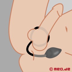 Alpha Male Cock Ring med butt plug