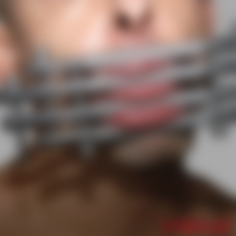 Silentium Tongue Gag - Lip Gag - 3